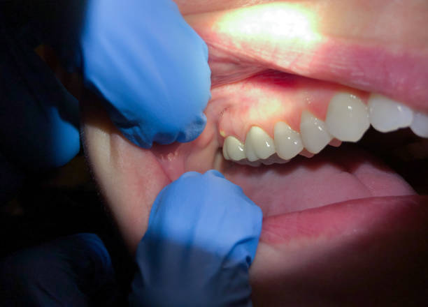 Best Emergency Tooth Extraction  in Herscher, IL